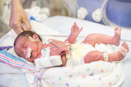 Bantuan Pengobatan Bayi Prematur